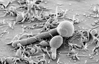 Parasites and their impact on health